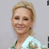 Die Schauspielerin Anne Heche hatte einen Autounfall in Los Angeles.