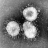 So sieht das neue Coronavirus unter dem Mikroskop aus.