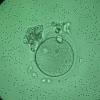 Was bringt Spermien dazu, in eine Eizelle einzudringen? Lange war das unklar. Nun haben Forscher festgestellt, welches Rezeptorprotein dafür verantwortlich ist.