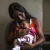 Ein an Mikrozephalie erkrankter Säugling in Rio.