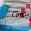 Proben für Corona-Tests werden für die weitere Untersuchung vorbereitet. 