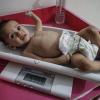 Eine Krankenschwester ermittelt das Gewicht eines unterernährten Kindes im Ibn Sina Krankenhaus in Idlib. .  