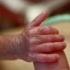 Die winzige Hand eines Frühchens (Archiv). Ein in der 22. Woche geborenes Frühchen hat überlebt dpa