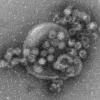 Elektronenmikroskopische Aufnahme von Noroviren: Bei 32 Sicherheitskräften der Olympischen Winterspiele wurde das Virus nachgewiesen.