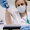 Eine Krankenschwester bereitet einen PCR-Tests zur Erkennung des Affenpockenvirus vor.
