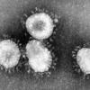 Das MERS-Virus führte in Saudi-Arabien bereits zu 168 Todesfällen. Mutiert es, befürchten Experten eine Epidemie.
