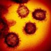 Das Foto zeigt im Labor kultiviertes Coronavirus.