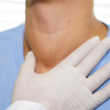 Ein Jod-Mangel kann sich als Symptom anhand einer sichtbaren Schwellung am Hals zeigen.