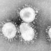 Dieses undatierte Handout des amerikanischen Centers for Disease Control CDC zeigt einen Coronavirus unter dem Mikroskop.