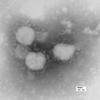 Ein Bild des neuartigen Coronavirus.