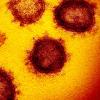 Coronaviren unter dem Mikroskop: Die winzigen Erreger werden durch Niesen oder Husten übertragen. 