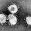 Die Weltgesundheitsorganisation sieht im neuen Coronavirus MERS eine Gefahr für die ganze Welt. Die Zahl der Todesfälle steigt, vor allem in Saudi-Arabien.