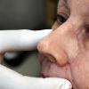 Das Nasen-Provisorium für Erika Schuster sitzt tadellos. Im nächsten Schritt wird das richtige Modell angefertigt, das dann auch farblich an die Haut der Patientin angepasst wird.