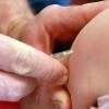 Ärtze fordern eine Pflicht zur Masernimpfung.