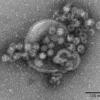 Elektronenmikroskopische Aufnahme von Noroviren: Eine Infektion läuft meist kurz und heftig ab. Foto: Robert-Koch-Institut dpa