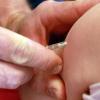 Gesundheitsbehörden empfehlen die Masernimpfung: Die hoch ansteckende Infektionskrankheit mit den typischen roten Hautflecken kann auch zu lebensbedrohlichen Komplikationen führen.