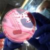 EHEC-Bakterienstämme in einer Petrischale: Durch den gefährlichen Darmkeim sind wahrscheinlich bereits drei Menschen gestorben. Oft wird fälschlicherweise über einen Virus geschrieben. dpa