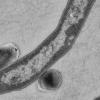 Der Tuberkulose-Erreger Mycobacterium tuberculosis, aufgenommen unter dem Elektronenmikroskop: Mitschüler und Lehrer des erkrankten Jugendlichen mussten sich nun auch untersuchen lassen.