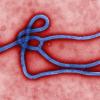 Das Ebola-Virus gehört zu den gefährlichsten Krankheitserregern der Welt. Es löst hämorrhagisches - mit Blutungen einhergehendes - Fieber aus.