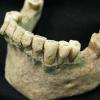 Versteinerter Zahnstein aus einem prähistorischen Schädel als DNA-Quelle.