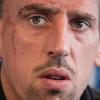Franck Ribéry hat mit muskulären Problemen zu kämpfen. Noch ist offen, ob der Franzose rechtzeitig fit für das Spiel gegen Kaiserslautern wird.