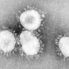 Winzig klein und doch hochgefährlich sind die Coronaviren.
