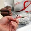 Aids: Der Immunschwäche Aids sind weltweit bislang mehr als 25 Millionen Menschen zum Opfer gefallen. 