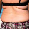 Übergewichtige sollen nach den Vorstellungen der CDU stärker zur Kasse gebeten werden. Bild: dpa
