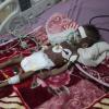 Ein unterernährtes Mädchen wird in einem Krankenhaus im jemenitischen Sanaa behandelt.