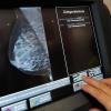 Ein Brustkrebs-Screenings ist für viele Frauen obligatorisch.