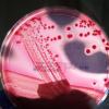 Eine Petrischale mit EHEC-Bakterienstämmen auf einem speziellen Nährboden. HUS ist besonders gefährlich. dpa