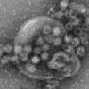 Der Norovirus breitet sich heuer früher aus als in den Vorjahren.