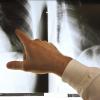 Wer zum Facharzt muss, muss mit Wartezeiten rechnen. Ein Orthopädie-Arzt zeigt in seiner Praxis mit der Hand auf das Röntgenbild mehrerer Rippen. 