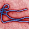 Ebola-Virus: Weltweit wahrgenommen wurde das Ebola-Virus zum ersten Mal im Jahr 1976.  Bis zu 90 Prozent der Betroffenen überleben den schweren Krankheitsverlauf nicht.