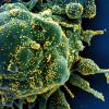 Auf dieser vom US-Forschungszentrum National Institute of Allergy and Infectious Diseases (NIAID) zur Verfügung gestellten Aufnahme ist eine Zelle (grün) mit dem Coronavirus (gelb) infiziert. Die Pandemie gilt mittlerweile als beendet.  