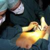 Ein Silikonimplantat wird am Montag durch einen drei Zentimeter langen Schnitt in der Mannheimer Klinik für plastische Chirurgie in der Achselhöhle bis unter die Brust geschoben. 