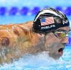 Zahlreiche braune Flecken zieren den Körper von Michael Phelps. Dabei handelt es sich um die Produkte chinesischer Heilkunst.