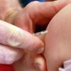 Ein Kinderarzt gibt einem Kind eine Masernimpfung.