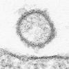 Das undatierte, mit einem Elektronenmikroskop hergestellte Handout Bild zeigt das Schmallenberg-Virus (Mitte) mit einem Durchmesser von 100 Nanometern in einer 150.000-fachen Vergrößerung. Forschern des Friedrich-Loeffler-Instituts (FLI) auf der Insel Riems ist es gelungen, das sogenannte Schmallenberg-Virus erstmals sichtbar zu machen. 