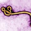 Das Ebola-Virus.