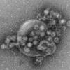 So sehen Noroviren unter dem Mikroskop aus.