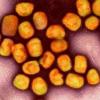 Eine kolorierte transmissionselektronenmikroskopische Aufnahme von Partikeln des Affenpockenvirus (Gold).