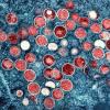 Die Zahl der bestätigten Fälle von Affenpocken – hier eine Aufnahme von Partikeln des Virus (rot) in einer infizierten Zelle (blau) – ist in Augsburg überschaubar. 