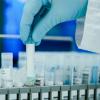 PCR-Tests haben den Staat und Krankenkassen in der Corona-Pandemie bisher mehr als sechs Milliarden Euro gekostet.