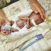 Ein zu früh geborenes Baby im Children's Hospital of Philadelphia. Kann eine künstliche Gebärmutter in Zukunft die Überlebenschancen von extremen Frühchen verbessern?