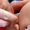 Impfung gegen Masern. Masern verursachen einen erheblich geschwächten Allgemeinzustand.