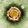 Coronavirus: Experten glauben, dass sich der Virus von Mensch zu Mensch überträgt. Saudi-Arabien meldet weitere Tote.