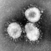 Ein Coronavirus unter dem Mikroskop. Inzwischen haben sich Mutationen entwickelt.