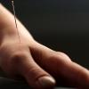 Die Akupunktur etwa gehört zu den Behandlungsmethoden, die viele Heilpraktikerinnen und Heilpraktiker anbieten. Die Zahl der Naturheilpraxen im Freistaat ist seit Jahren auf Wachstumskurs.