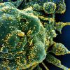 Eine Zelle (grün) mit dem Coronavirus (SARS-CoV-2, gelb) infiziert. Angesichts von Wissenslücken über die neue Erkrankung sind Obduktionen für Ärzte sehr wichtig.
